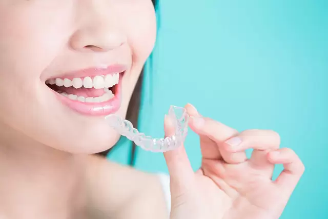 clear braces cost singapore