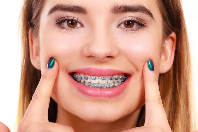 Invisalign Braces Cost Singapore