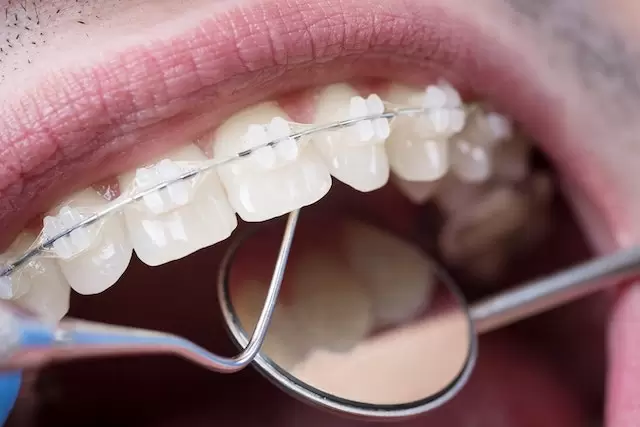 Good Orthodontist Singapore
