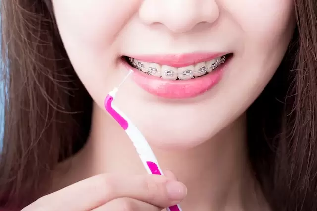 Singapore Braces Instalment