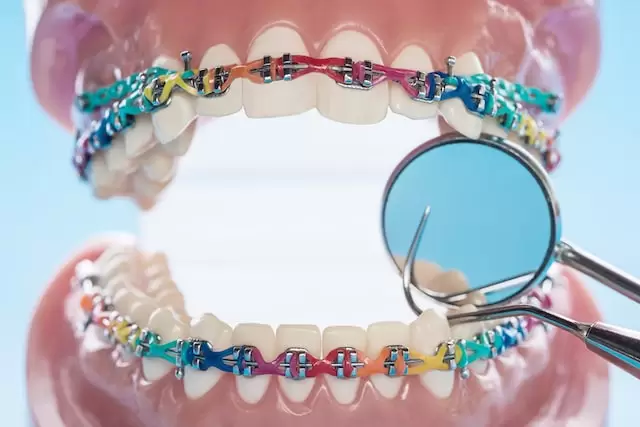 Good Orthodontist in Singapore