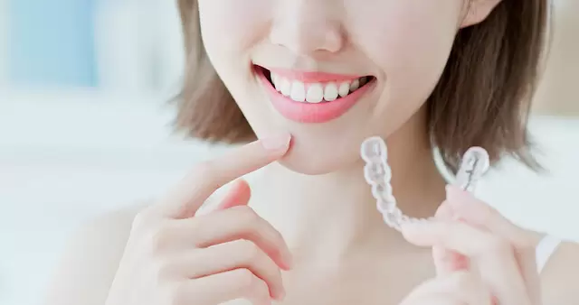 Recommended Braces, Good Orthodontist Singapore