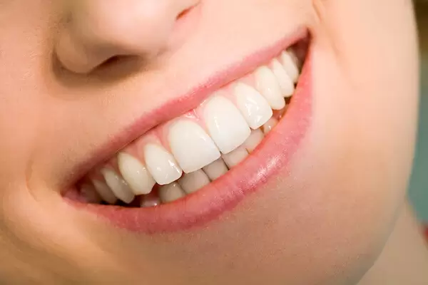 Good Orthodontist In Singapore, Braces Cost