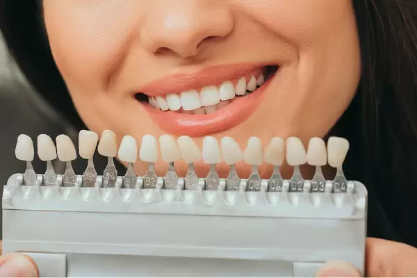 Teeth Whitening Misconceptions That Need To Be Debunked