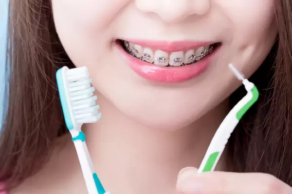 The Secrets To Maintaining Your Metal Braces In Top Condition