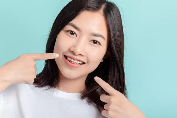 How You Can Prepare Yourself Before Getting Braces Attached