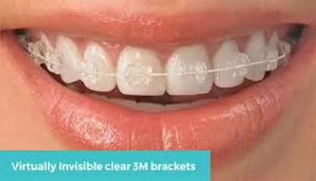 Good Orthodontist Singapore