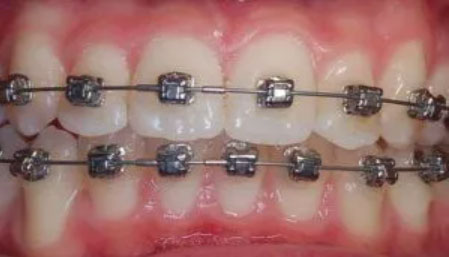 Good Orthodontist