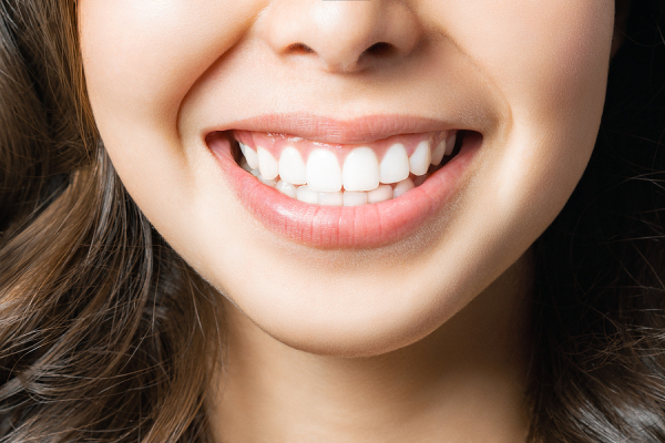 Getting Teeth Whitened: Is It Possible With Braces On?