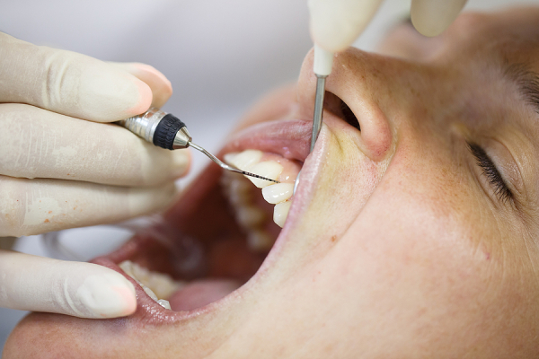 6 Risk Factors & Habits That Leads To Periodontal Diseases