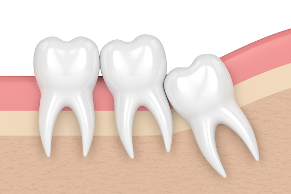 Posterior Crowding: Everything You Need To Know About It